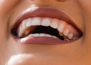 quiz dents humaines