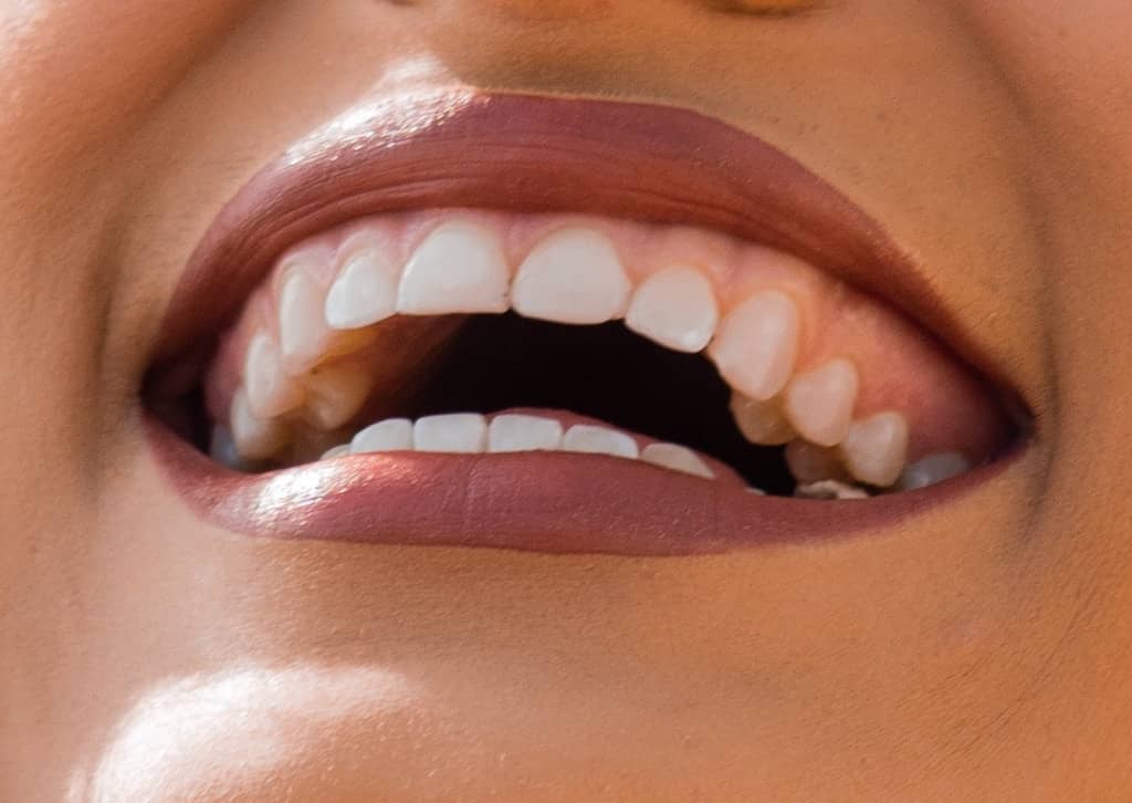 Quiz : les dents humaines (avec r&eacute;ponses) 🦷
